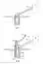 Fig. 07 - Suture anchor and associated methods of use