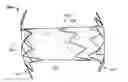 Fig. 01 - Anastomosis devices