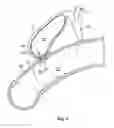 Fig. 02 - Anastomosis devices