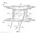 Fig. 04 - Anastomosis devices