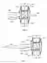 Fig. 06 - Anastomosis devices