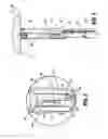 Fig. 05 - Anvil assembly of circular stapling device including alignment splines