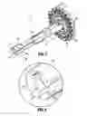 Fig. 08 - Surgical stapling apparatus with staple sheath