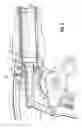 Fig. 06 - Endoscopic surgical clip applier