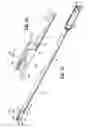 Fig. 12 - Endoscopic surgical clip applier