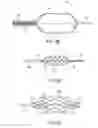 Fig. 10 - Methods of intracerebral implant delivery