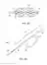 Fig. 11 - Methods of intracerebral implant delivery