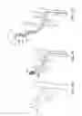 Fig. 14 - Methods of intracerebral implant delivery