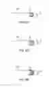 Fig. 15 - Methods of intracerebral implant delivery