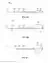 Fig. 18 - Methods of intracerebral implant delivery