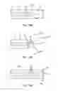 Fig. 20 - Methods of intracerebral implant delivery