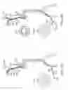 Fig. 41 - Methods of intracerebral implant delivery