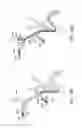 Fig. 43 - Methods of intracerebral implant delivery