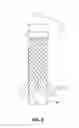 Fig. 06 - Vascular occlusion devices and methods