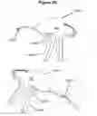 Fig. 26 - Handheld surgical instrument