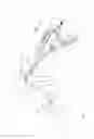 Fig. 108 - Arthroscopic surgical device
