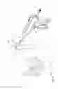 Fig. 113 - Arthroscopic surgical device