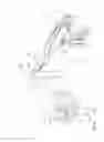 Fig. 114 - Arthroscopic surgical device