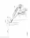 Fig. 116 - Arthroscopic surgical device