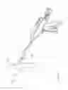 Fig. 120 - Arthroscopic surgical device