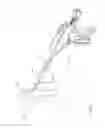 Fig. 121 - Arthroscopic surgical device
