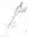 Fig. 122 - Arthroscopic surgical device