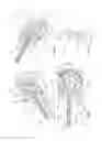 Fig. 17 - Arthroscopic surgical device