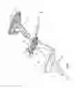Fig. 32 - Arthroscopic surgical device
