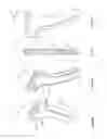 Fig. 46 - Arthroscopic surgical device