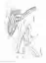 Fig. 56 - Arthroscopic surgical device