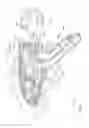 Fig. 57 - Arthroscopic surgical device