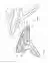 Fig. 58 - Arthroscopic surgical device