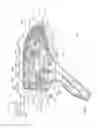 Fig. 59 - Arthroscopic surgical device