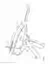 Fig. 62 - Arthroscopic surgical device