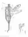 Fig. 65 - Arthroscopic surgical device