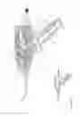 Fig. 71 - Arthroscopic surgical device