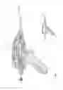 Fig. 76 - Arthroscopic surgical device