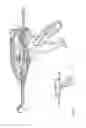 Fig. 79 - Arthroscopic surgical device
