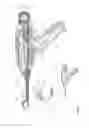 Fig. 88 - Arthroscopic surgical device