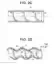 Fig. 04 - Flexible transport auger