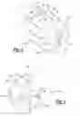 Fig. 03 - Surgical burs with localized auxiliary flutes