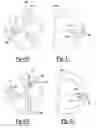 Fig. 15 - Surgical burs with localized auxiliary flutes