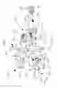Fig. 17 - Intramedullary nail alignment guides, fixation guides, devices, systems, and methods of use