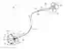 Fig. 01 - Medical retrieval device