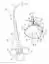 Fig. 03 - Medical retrieval device