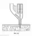Fig. 116 - Pixel array medical systems, devices and methods