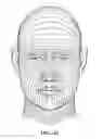 Fig. 132 - Pixel array medical systems, devices and methods