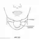 Fig. 133 - Pixel array medical systems, devices and methods