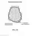 Fig. 138 - Pixel array medical systems, devices and methods
