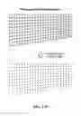 Fig. 141 - Pixel array medical systems, devices and methods